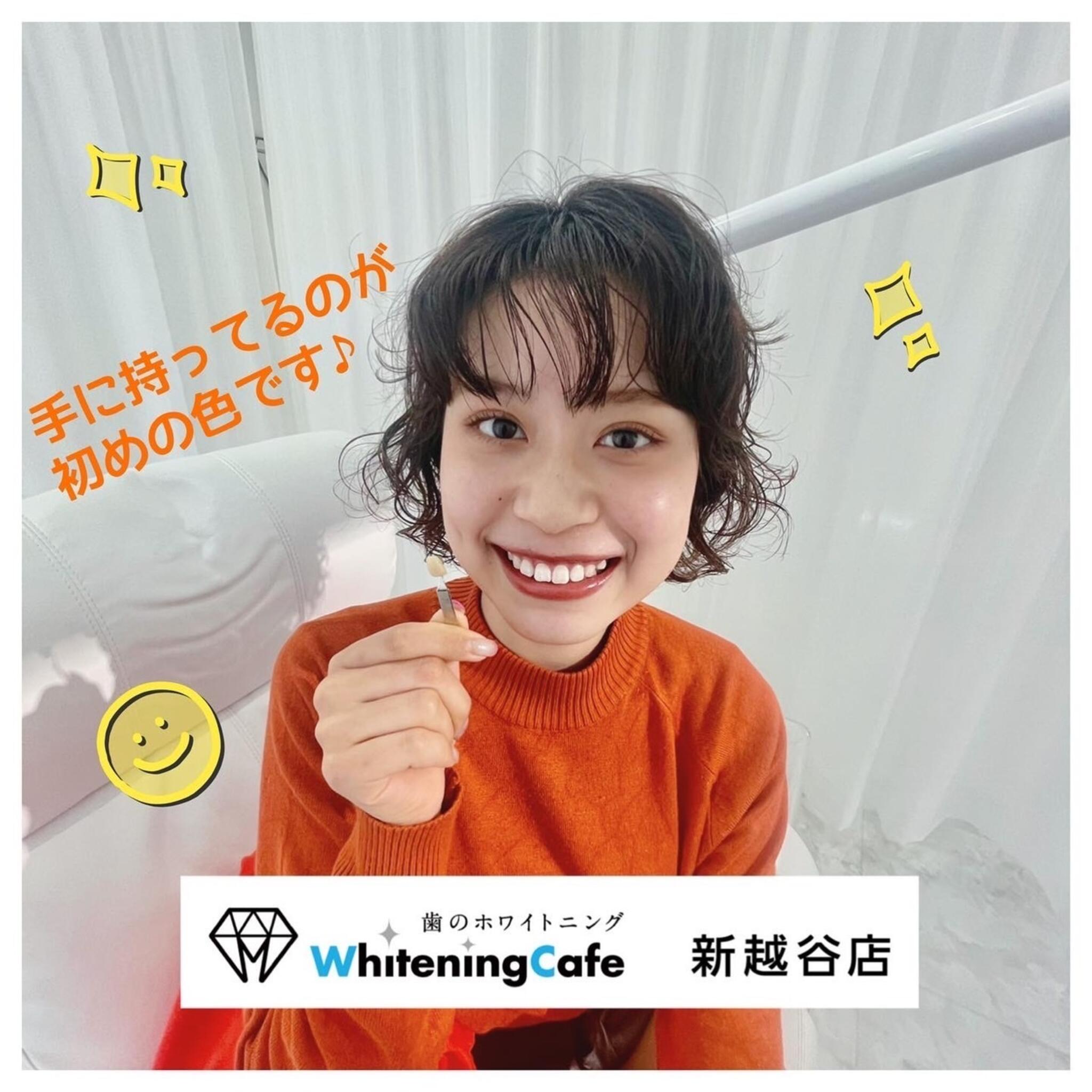 WhiteningCafe 新越谷店の代表写真4