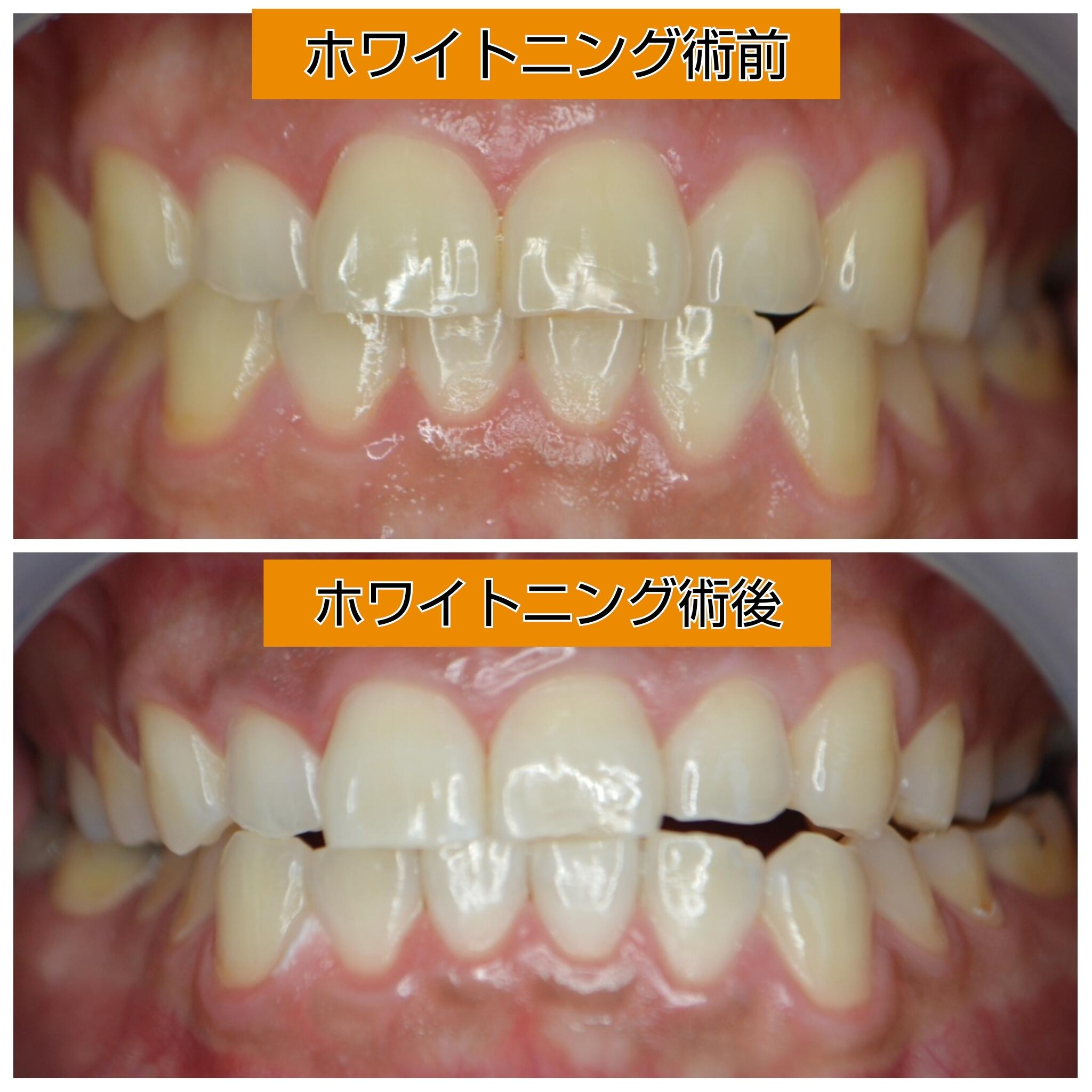 あらかわ歯科医院の代表写真8