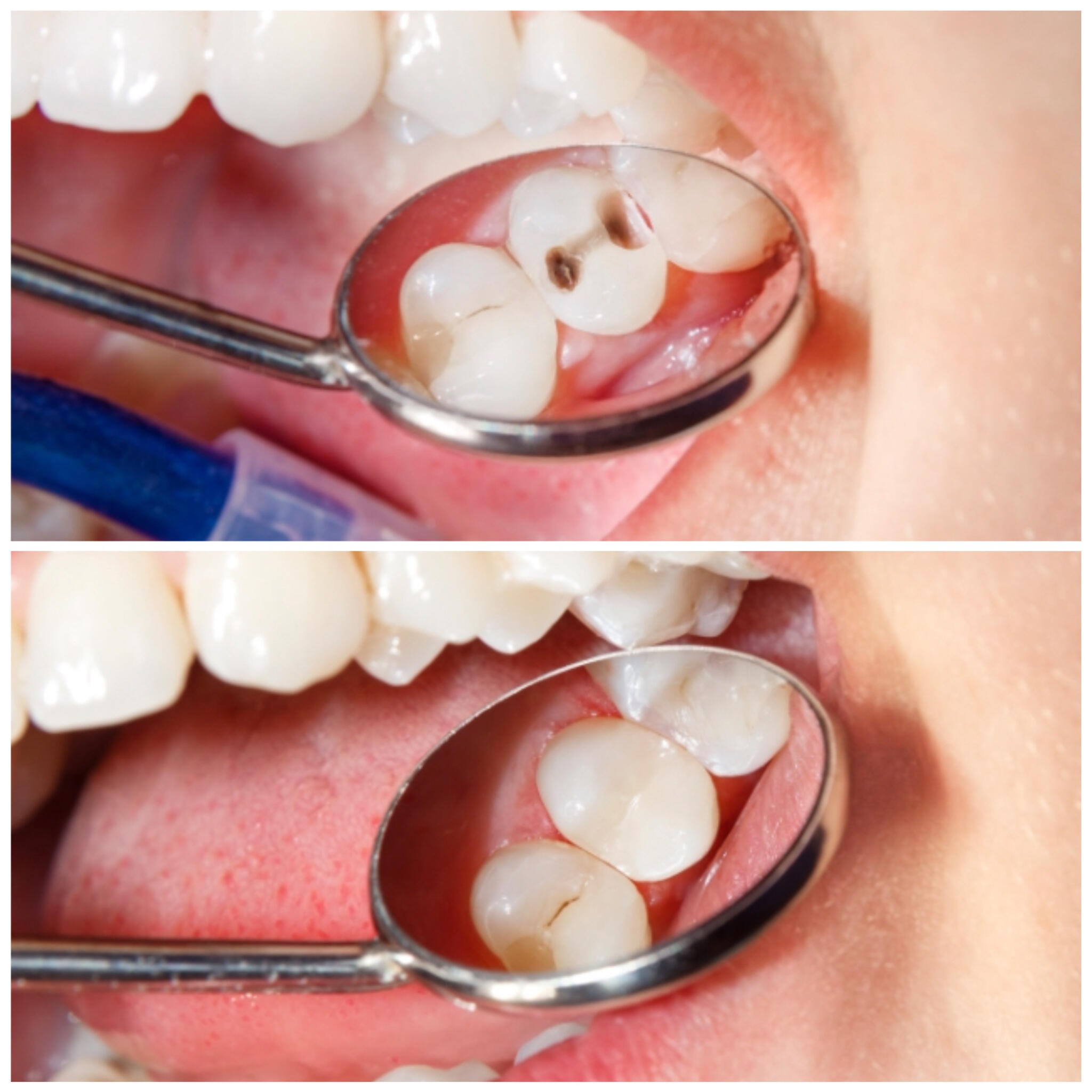 LeaLea歯科・矯正歯科クリニックの代表写真8