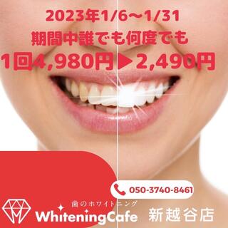 WhiteningCafe 新越谷店の写真24