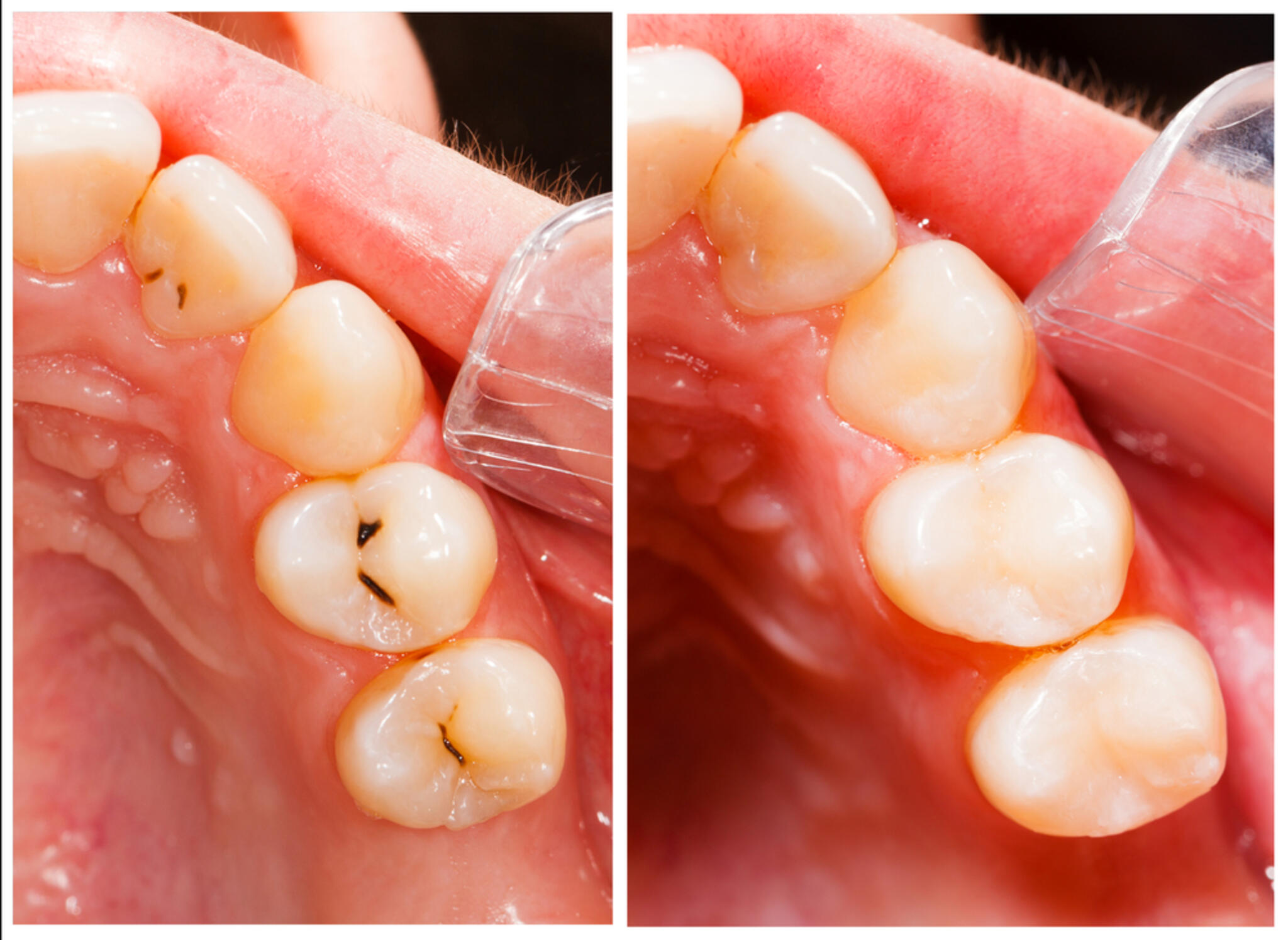 LeaLea歯科・矯正歯科クリニックの代表写真3