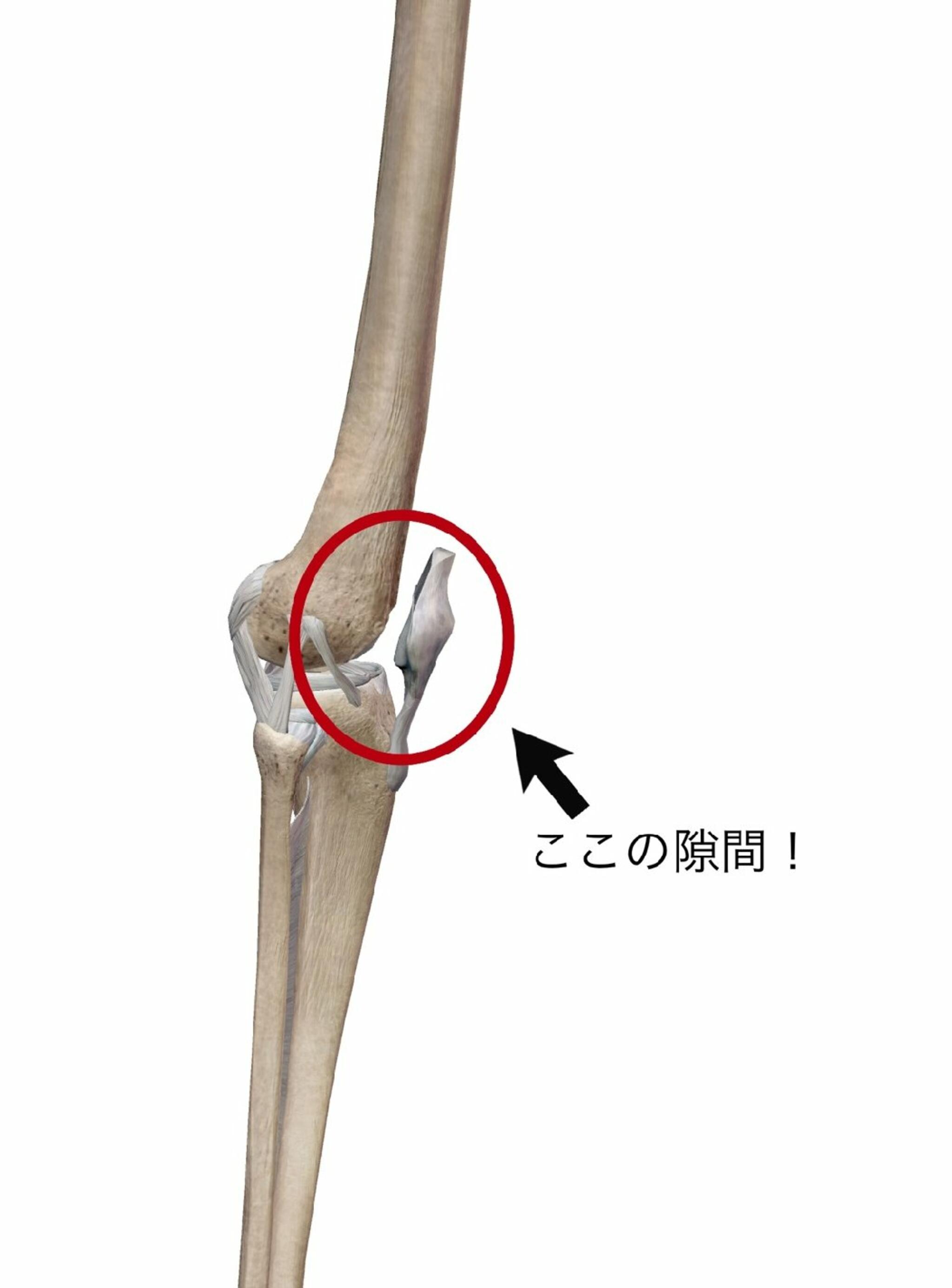 イーライフ鍼灸接骨院からのお知らせ(膝蓋大腿関節障害についてVol.2)に関する写真