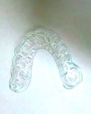 たべ歯科クリニックのマウスピース (価格 : )